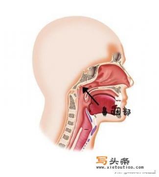 慢性鼻咽炎食什么药好？广字头的字哪些？