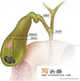 胃肠息肉术后1-7天食谱_求胆囊切除手术后恢复期食谱