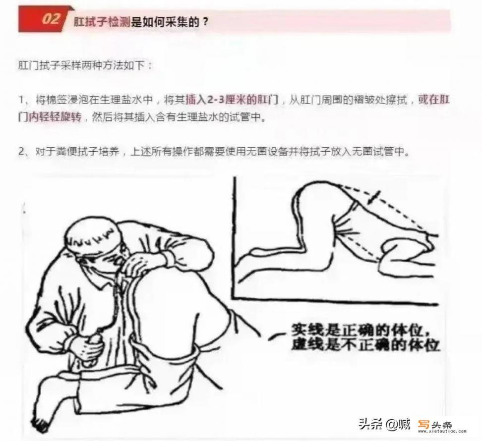 做了咽拭子，还要做肛拭子？大兴新冠病例为何增加肛拭子检测