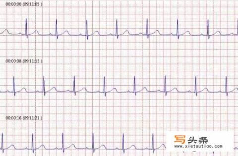 入职体检要求做查血、胸透、心电图三项，分别是检查什么？