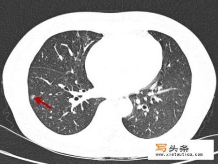 做一次肝的全面检查要多少钱？